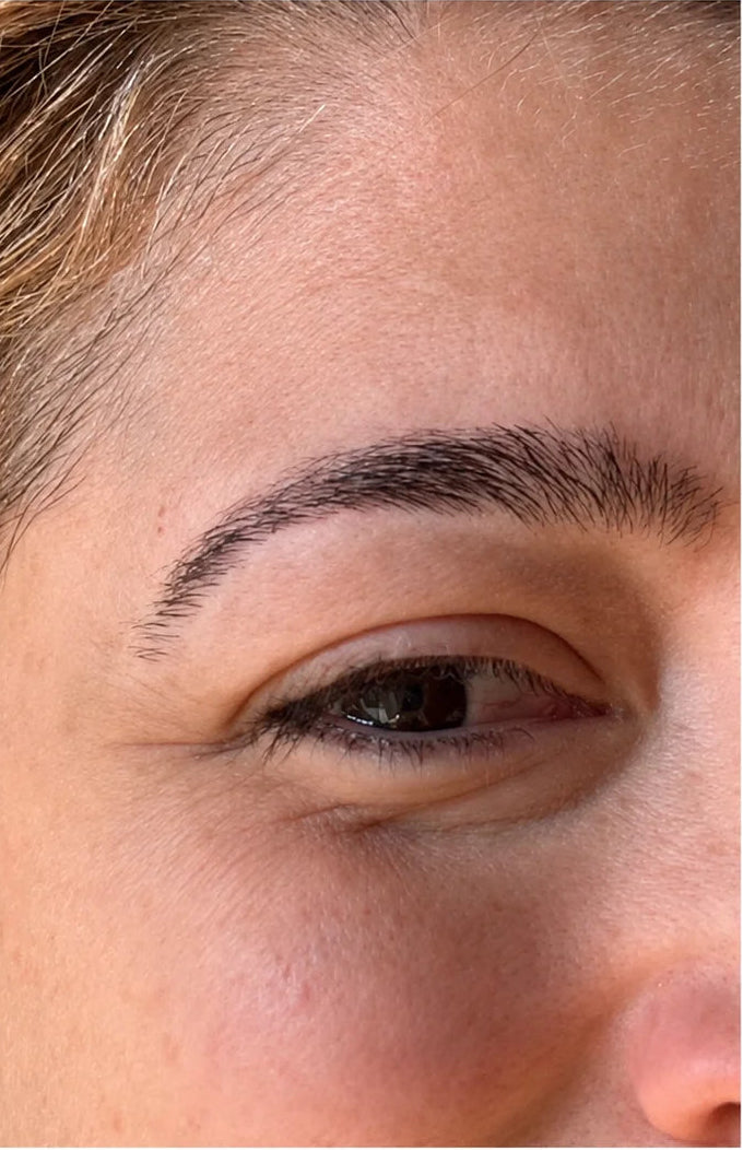 Image before